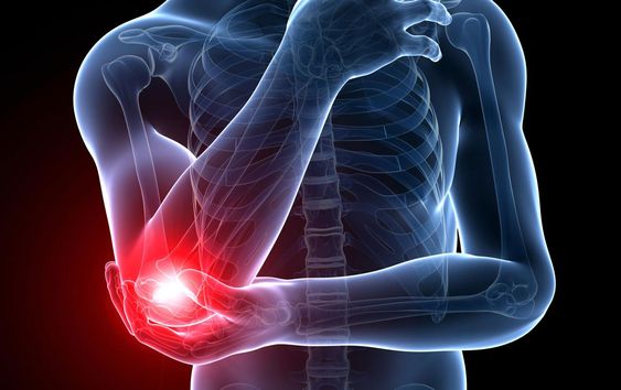 Tennis Elbow: What it is, Causes, Symptoms & Treatment